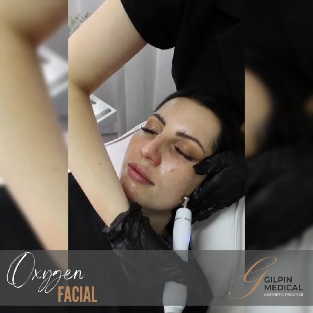 Oxygen Facial